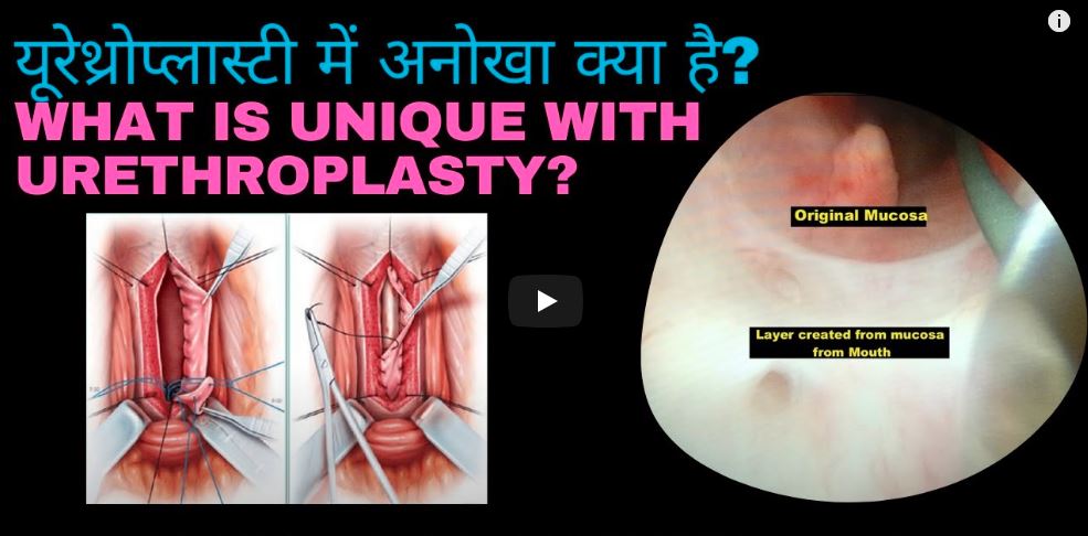 Why Urethroplasty has chance where OIU or urethral dilatation has failed or is bound to fail?