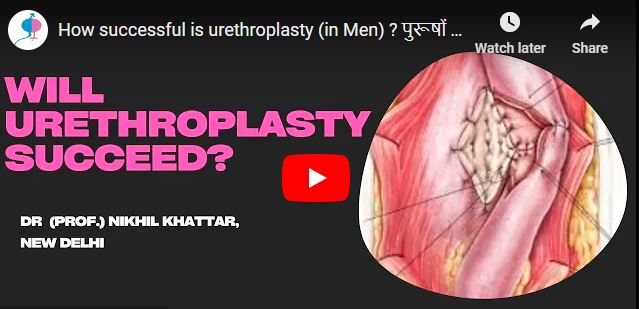 How successful is urethroplasty (in Men) ? पुरूषों में Urethroplasty ठीक रहेगी?