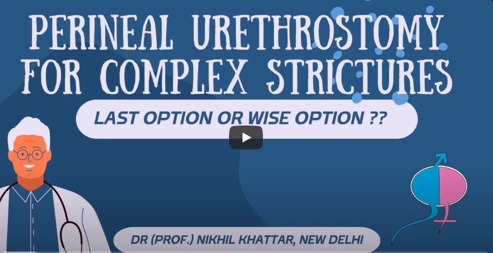 Perineal urethrostomy for Complex Strictures: Last option or Wise option?!!
