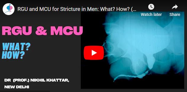 RGU and MCU for Stricture in Men: What? How? (No, it is not painful)