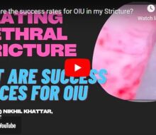 What are the success rates for OIU in my Stricture?