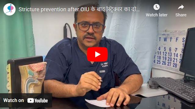 Stricture prevention after OIU के बाद स्ट्रिक्चर का दोबारा बनना कैसे बचायें?
